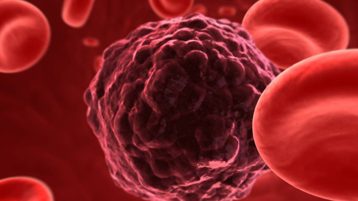 Día Mundial del Cáncer: Innovadores tratamientos son más eficaces y mejoran calidad de vida de pacientes