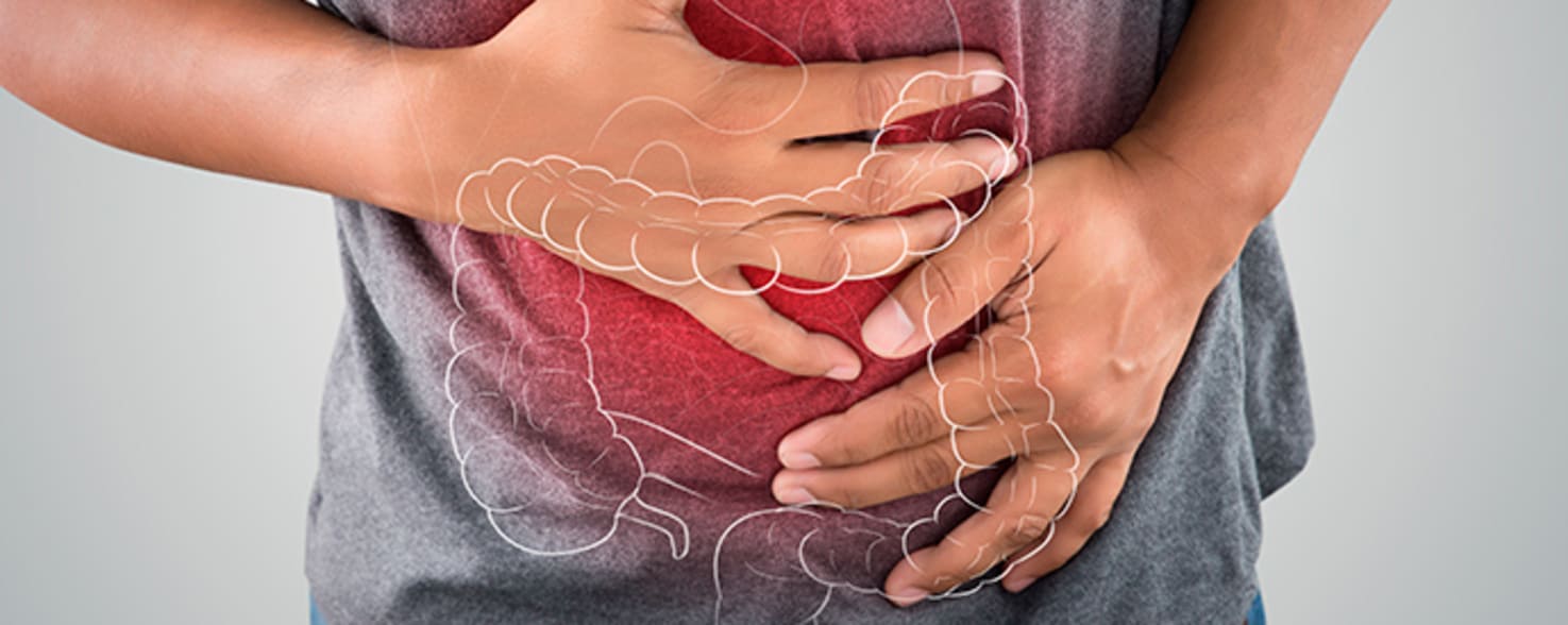 Enfermedades inflamatorias intestinales y su tratamiento en Chile