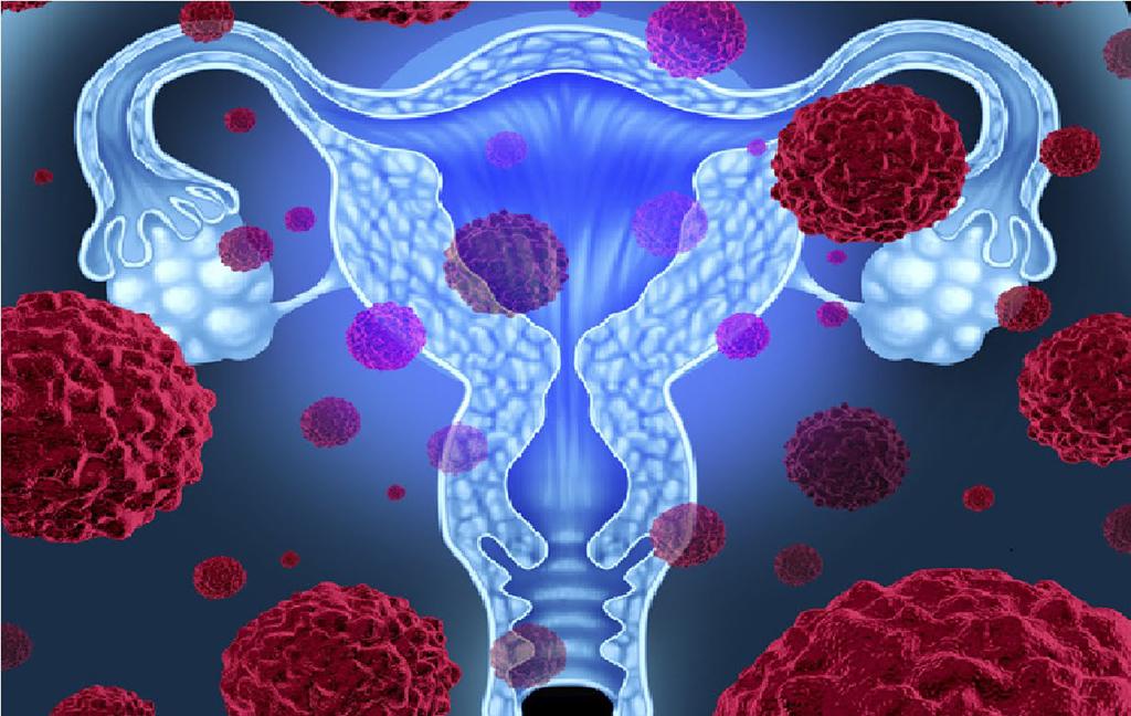 VPH: el virus silencioso que puede causar cáncer cervicouterino