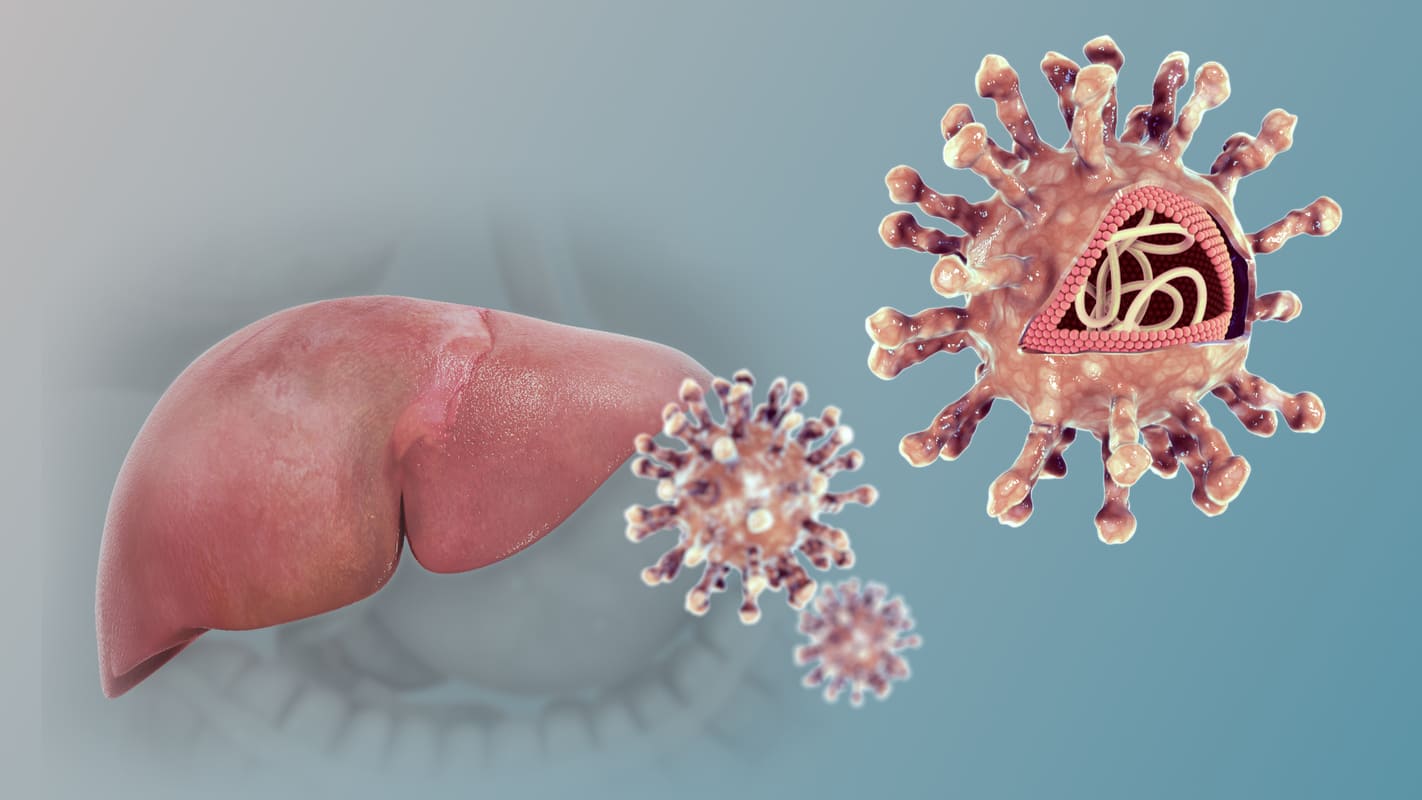 Hepatitis: la enfermedad que amenaza la salud del hígado