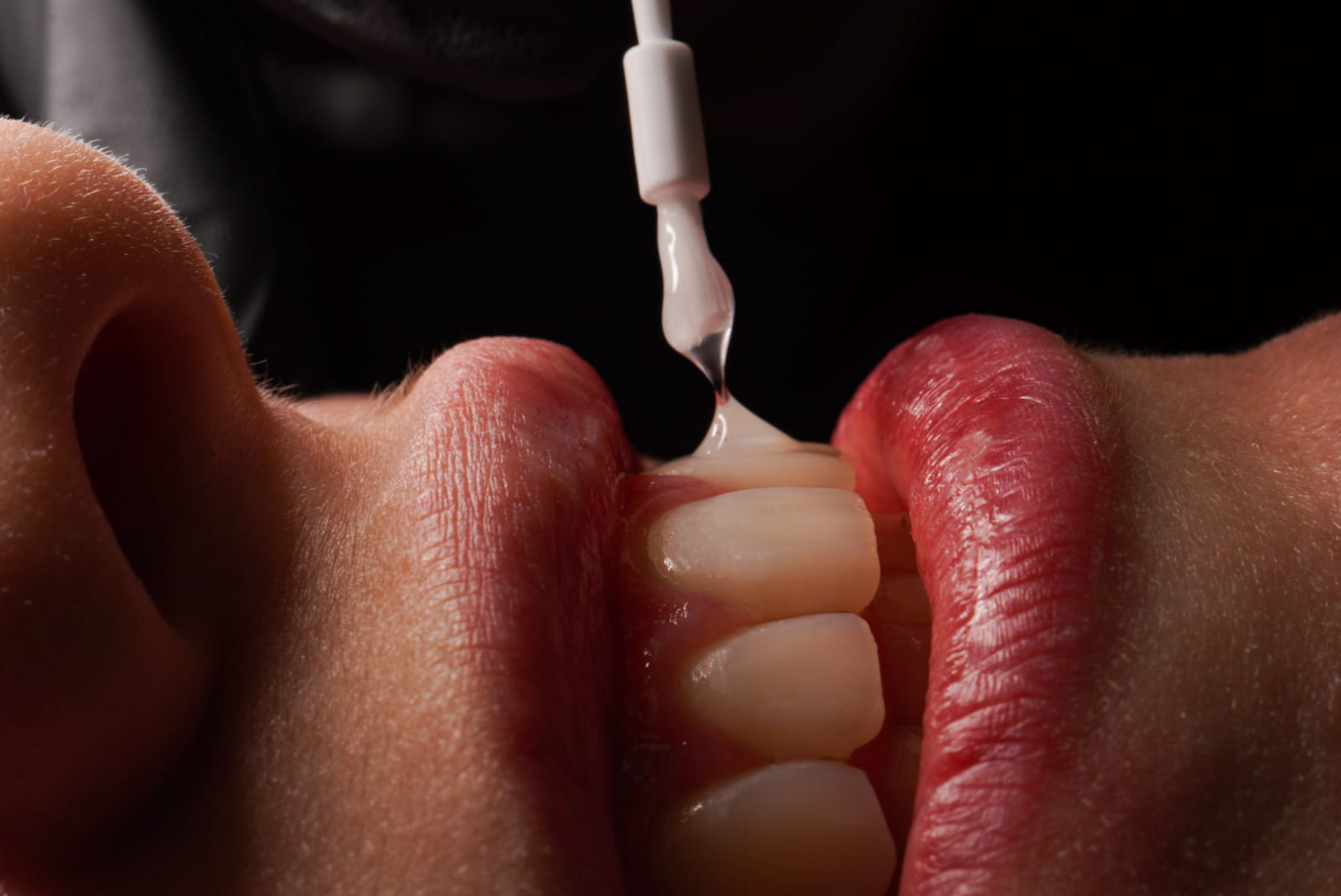 Salud bucal y cáncer: cómo prevenir complicaciones durante el tratamiento