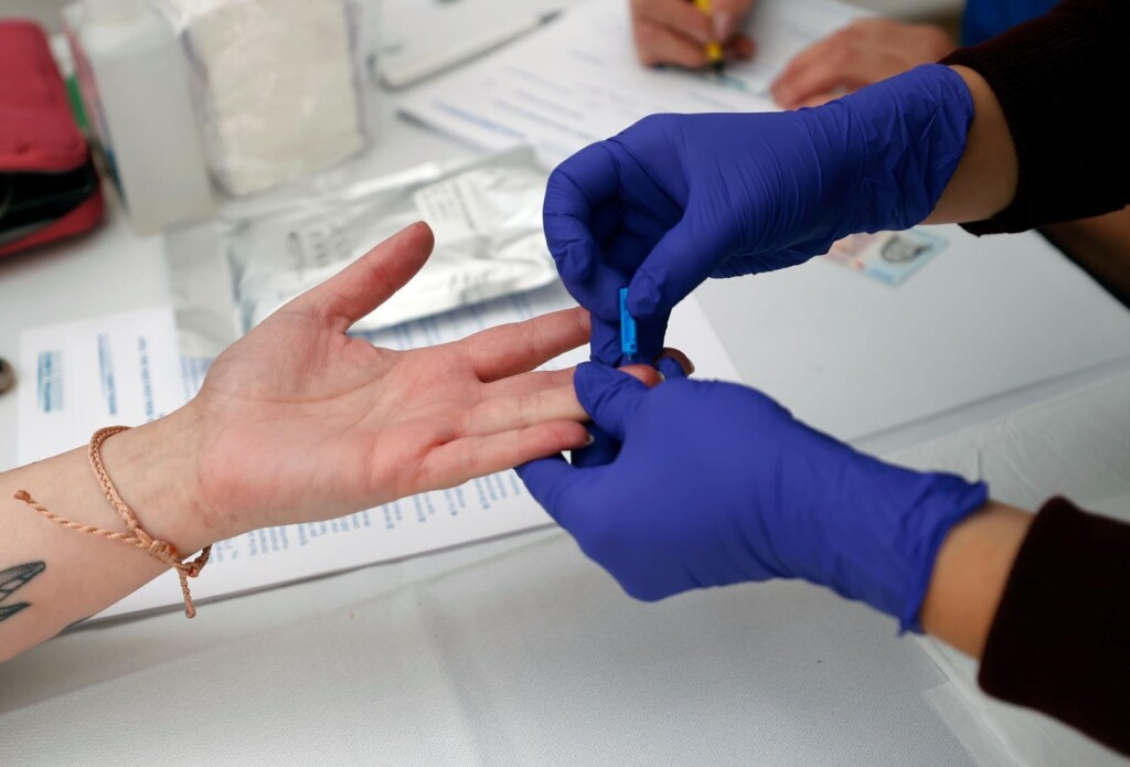 U. de Chile realizará jornada gratuita de testeo rápido de VIH por el Día Mundial del Sida