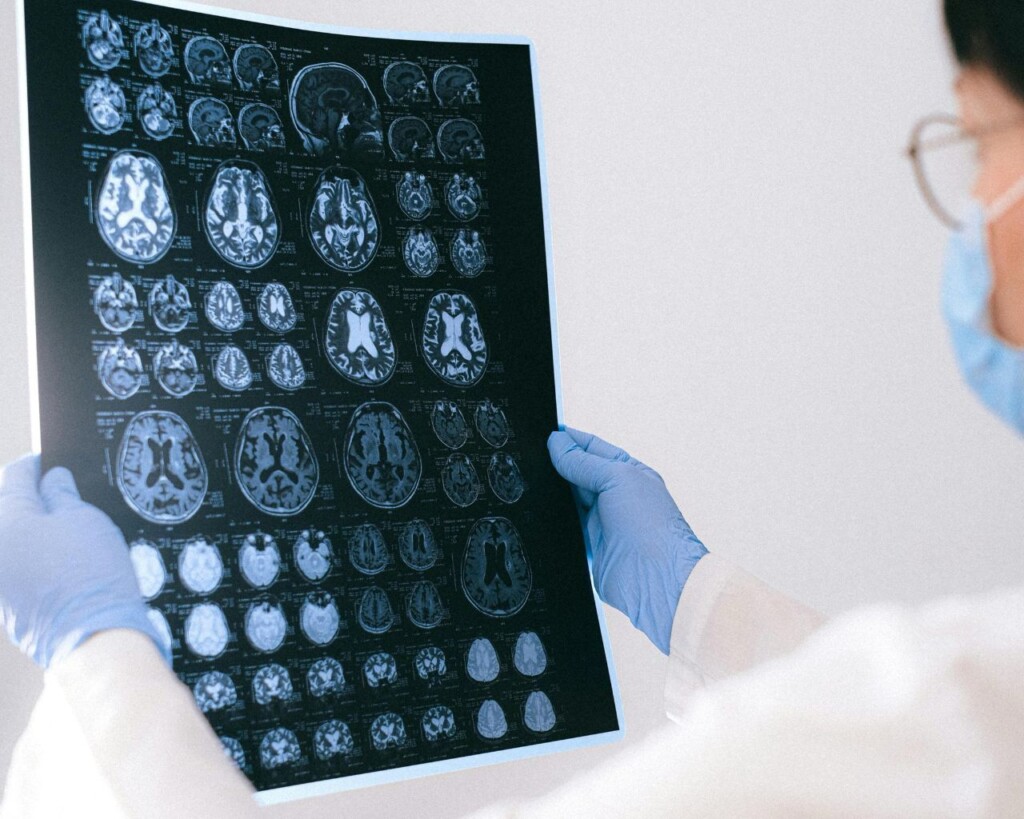 Año del Cerebro en Chile: experta advierte aumento de enfermedades neurodegenerativas y explica cómo funciona este órgano vital
