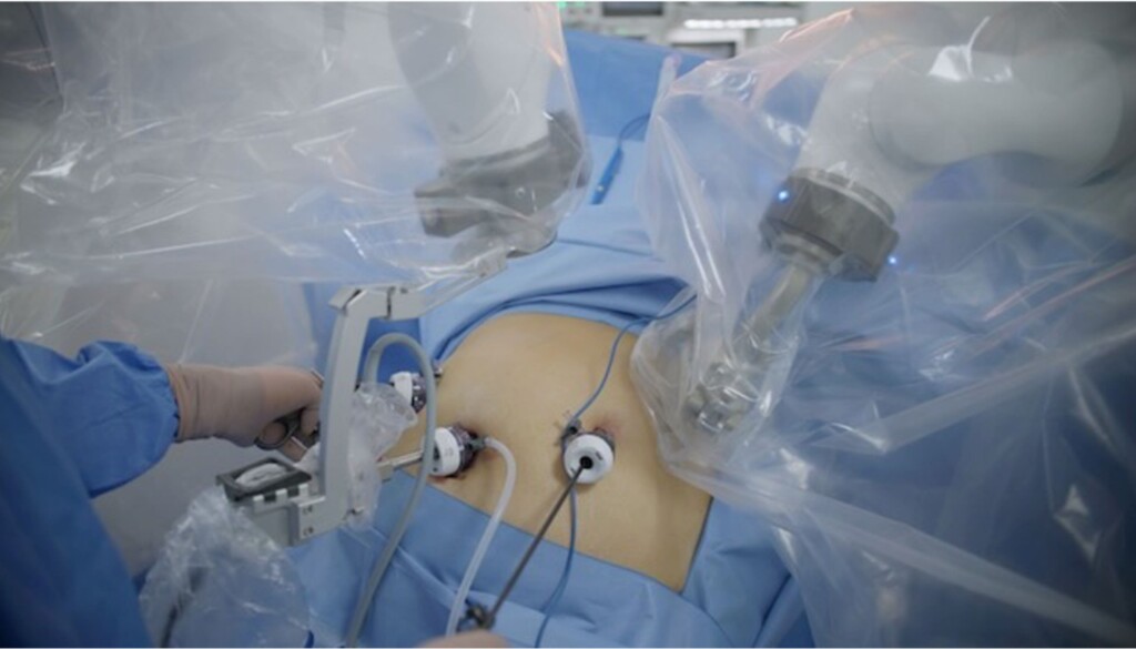 Chile realiza cirugías oncológicas con robot MARS